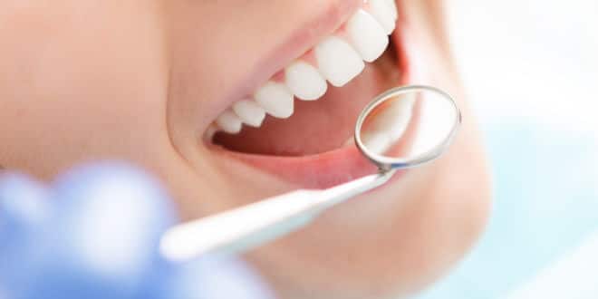 Zahnzusatzversicherung: Für wen lohnt sie sich?
