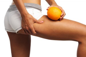 Cellulite - Orangenhaut