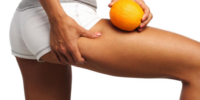 Cellulite - Orangenhaut