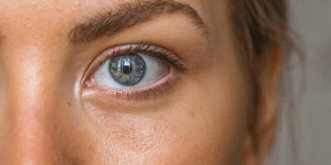 Auge