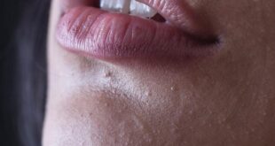 Lippen